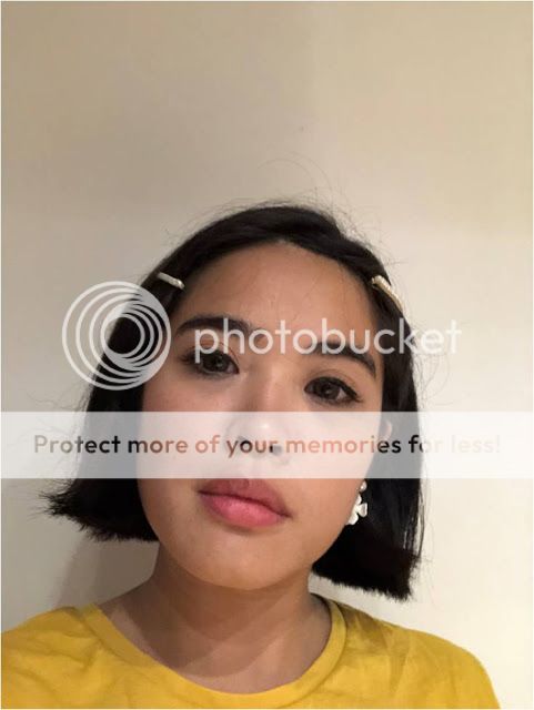 La Clinic Rejuran Healer Skinbooster Microbotox Singapore Dr Rachel Ho Review