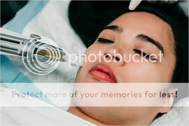 La Clinic Rejuran Healer Skinbooster Microbotox Singapore Dr Rachel Ho Review